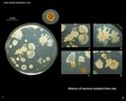 colonies of a gram-negative bacterium